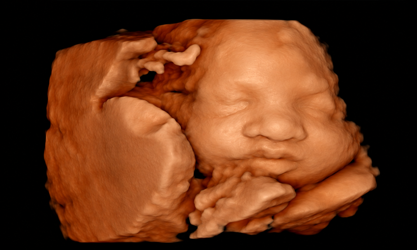 3D/4D ultrasound view of a baby's face