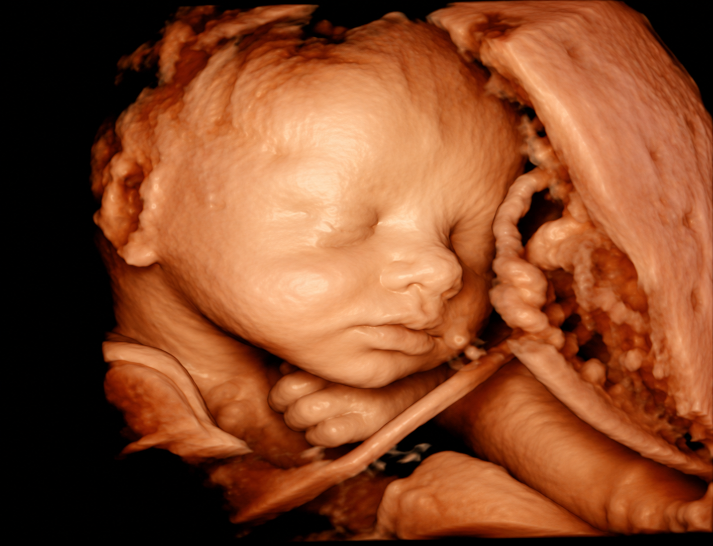 3D/4D ultrasound view of a baby