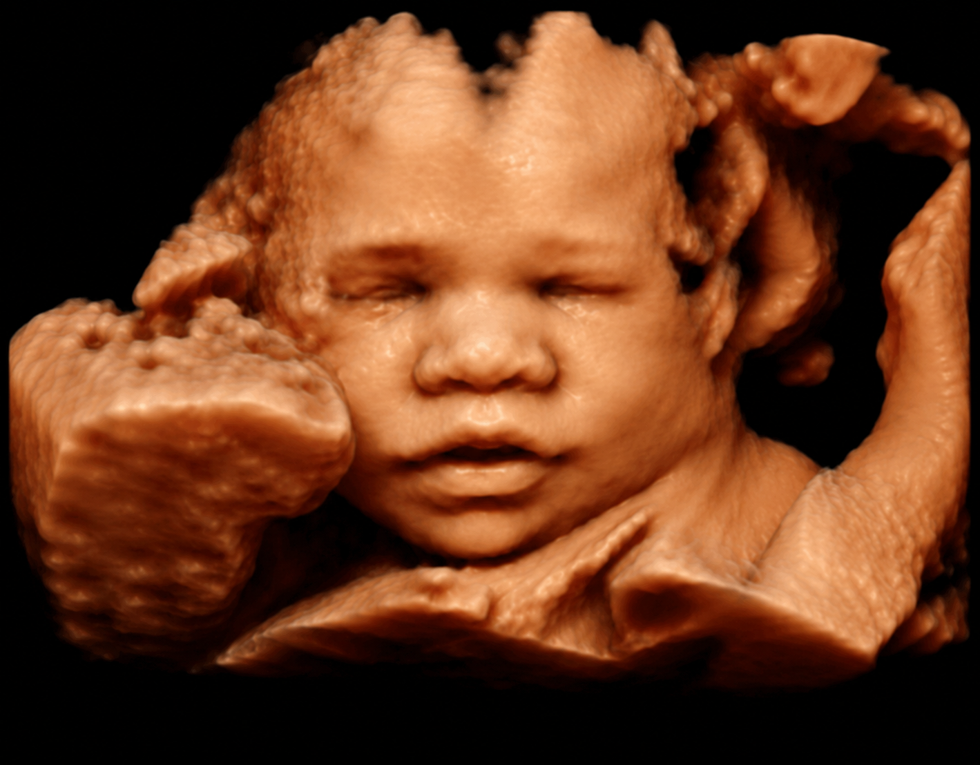 3D/4D ultrasound view of a baby